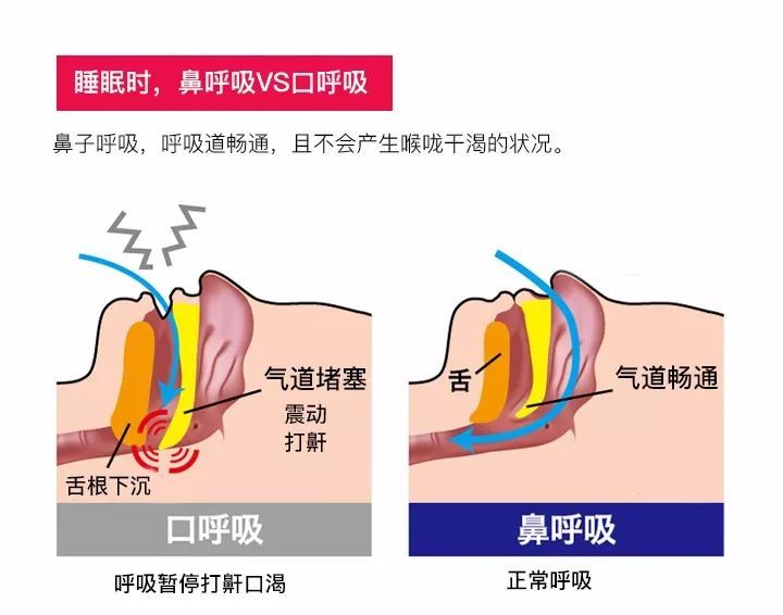 肺炎-哮喘-慢阻肺-咳嗽-咳喘-支氣管炎-肺功能檢測(cè)儀-呼吸訓(xùn)練器-心臟病-心血管疾病-口呼吸-整容-呼吸峰流速儀